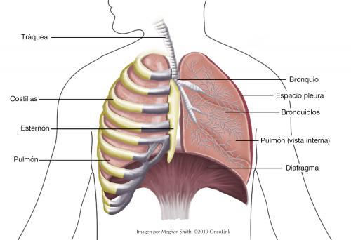 All About Mesothelioma Oncolink